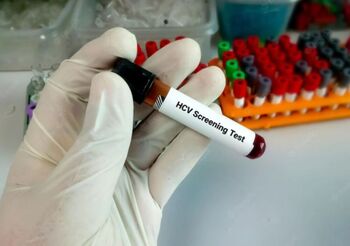 El cribado oportunista, clave en la eliminación de la hepatitis C
